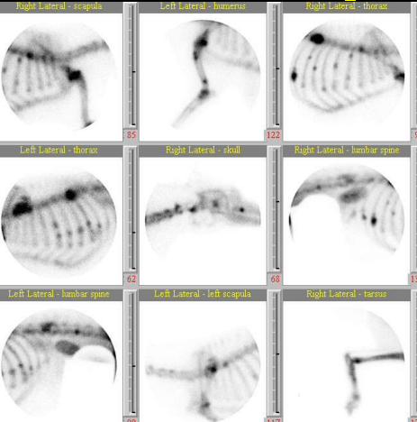 <ul><li><p><strong>Cause</strong></p><ul><li><p>Prostatic adenocarcinoma, transititional cell carcinoma, mammary adenocarcinoma</p></li></ul></li><li><p><strong>Signalment</strong></p><ul><li><p>Old animals</p></li></ul></li><li><p><strong>CS</strong></p><ul><li><p>generalized bone pain</p></li></ul></li><li><p><strong>RS</strong></p><ul><li><p><strong><u>Diaphyseal</u> </strong>reactions</p></li></ul></li></ul><p></p>