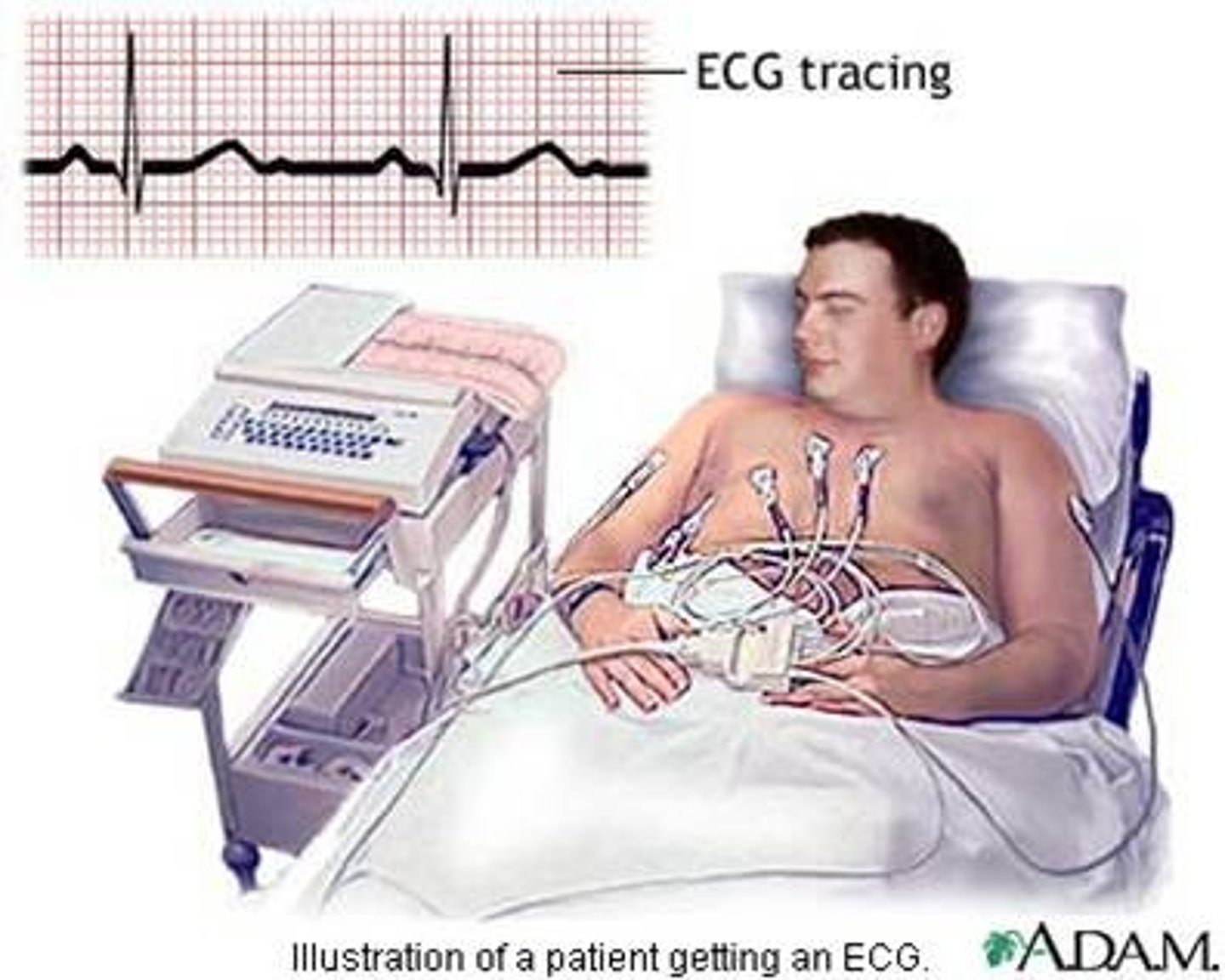 <p>process of recording</p>