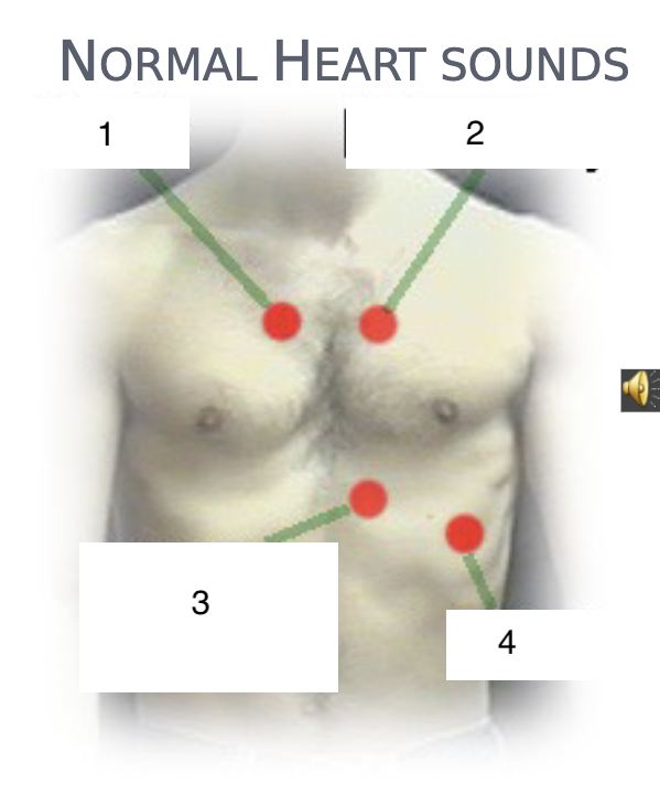 <p>What is heard when a stethoscope is placed at #4?</p>