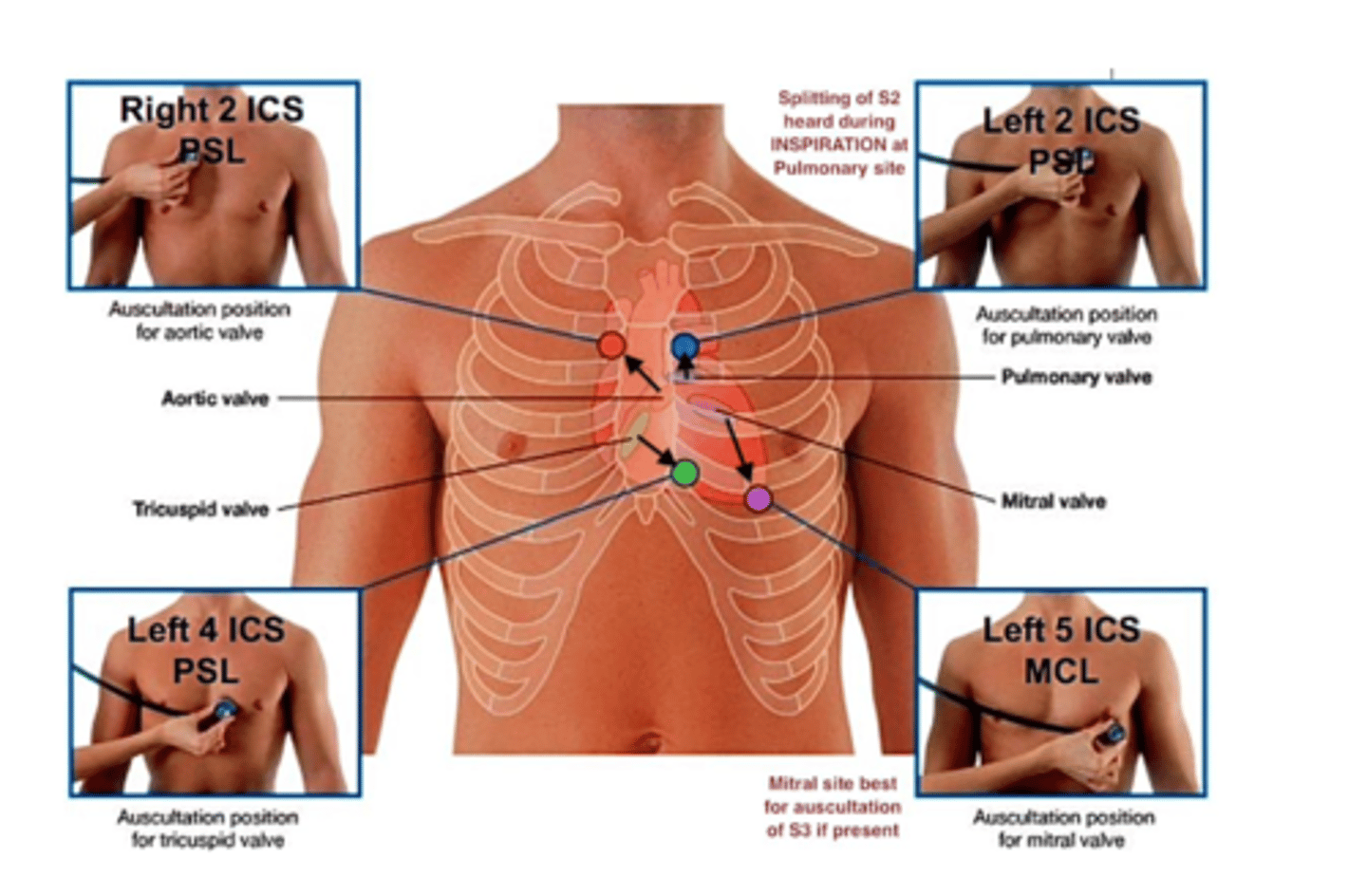 <p>-T o listen to the intensity and quality of heart sounds at chest surface</p><p>- To detect abnormality, not to Dx</p><p>- Perform in quiet, well-lit room</p><p>- Pt. should be undressed and draped</p><p>- Stethoscope should be directly on skin</p>