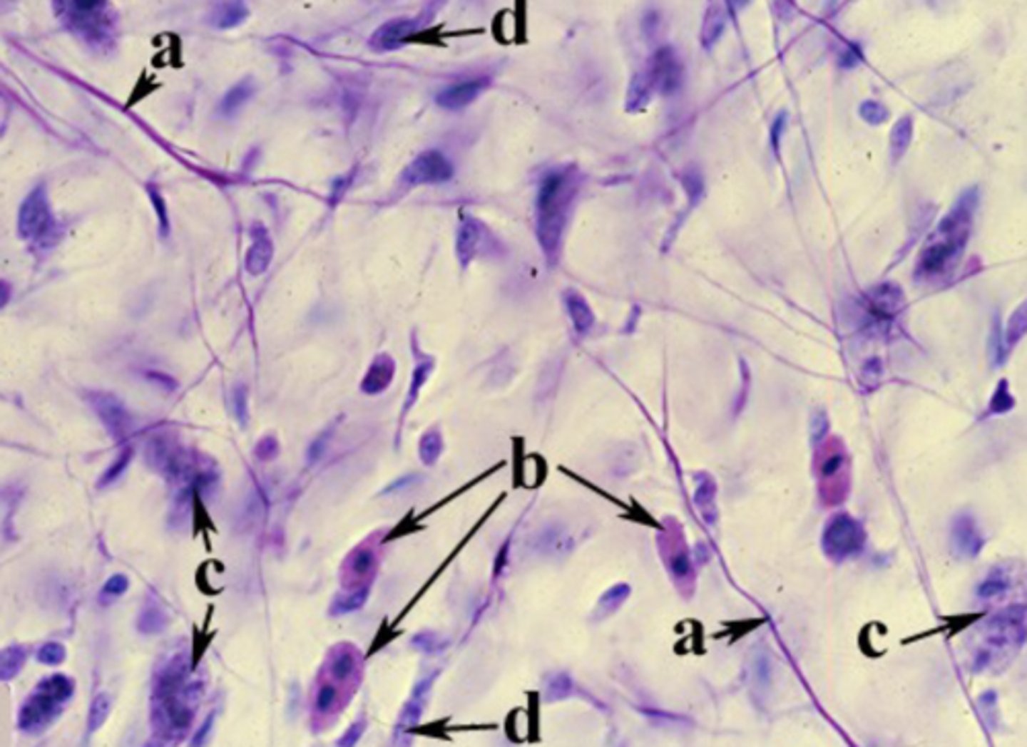 <p>Identify the cell type labeled "b"</p>