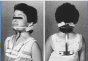 <p>Name this CTO. How is it constructed? Motion limitation?</p>