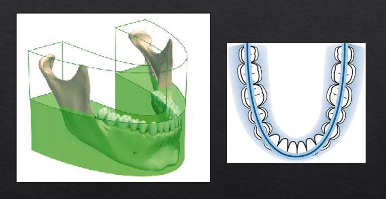 <ul><li><p>panoramic - small parts/images stitched together to form the full image</p></li><li><p>tomograph - refers to the part where we’re taking a slice through the patient’s anatomy </p></li><li><p><mark data-color="#beffd4" style="background-color: rgb(190, 255, 212); color: inherit;">horseshoe shaped slice ??</mark></p></li></ul><p><mark data-color="#deffdc" style="background-color: rgb(222, 255, 220); color: inherit;">anything within the green area is referred to as the focal troph - will be formed within the image </mark></p>