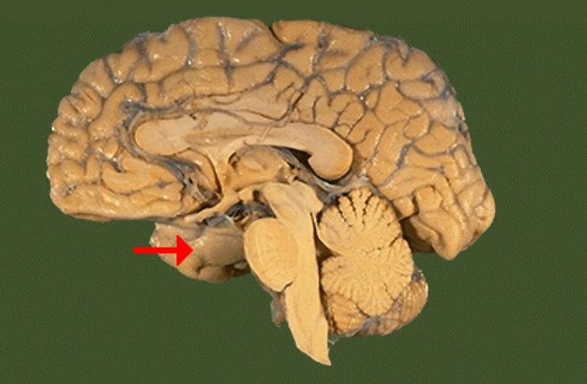 <p>Name this brain structure</p>