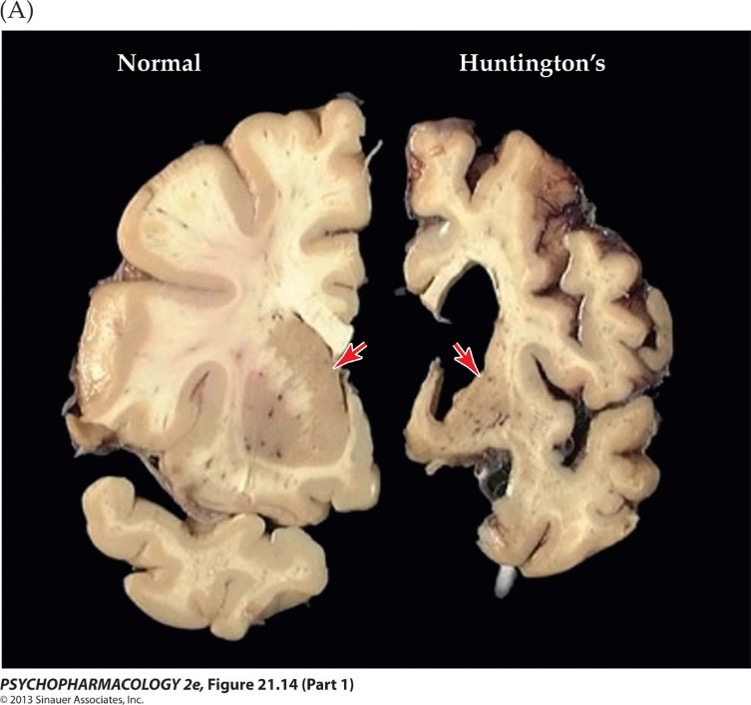 <p>Striatum: key player in motor control</p>