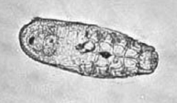 <p>Found in cats, contagious</p>