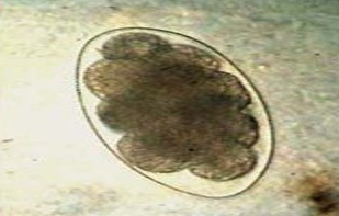 <p><span>This was found in a stool sample of an anemic sheep. &nbsp; What is it most likely to be?</span></p>