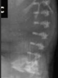 <ol><li><p>What is abnormal about this image?</p></li><li><p>This finding can be associated with what pathology?</p></li></ol><p></p>