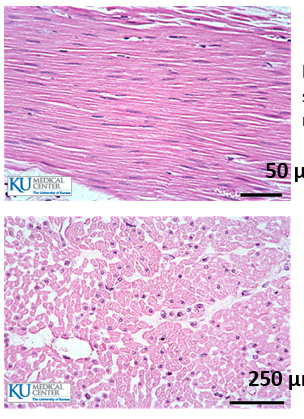 <ul><li><p>no striations</p></li><li><p>has a single nucleus per fibre</p></li><li><p>this muscle type is not under voluntary control</p></li></ul><p></p><p>Top image = longitudinal section of muscle</p><p>Bottom image = cross section of muscle</p>