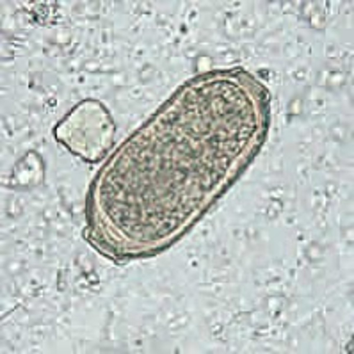 <p>APHASMID nematodes; PEANUT shaped egg; cause AUTOINFECTION</p><p>MOT: ingestion og LARVA in FISH</p>