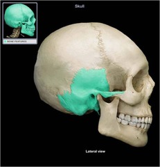 <p>bone that forms parts of the side of the skull and floor of the cranial activity.</p>