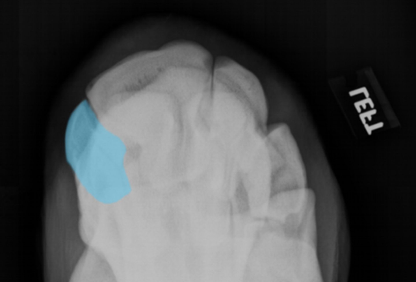 <p>What bone is highlighted?</p>