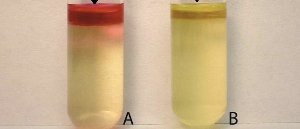 <p>What test is this?</p>