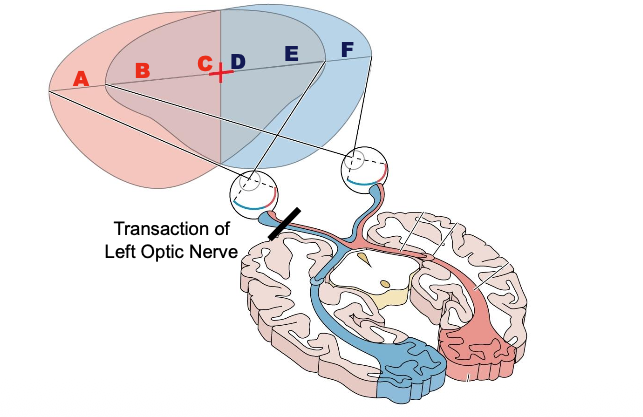 <p>Which letters can you read? </p>
