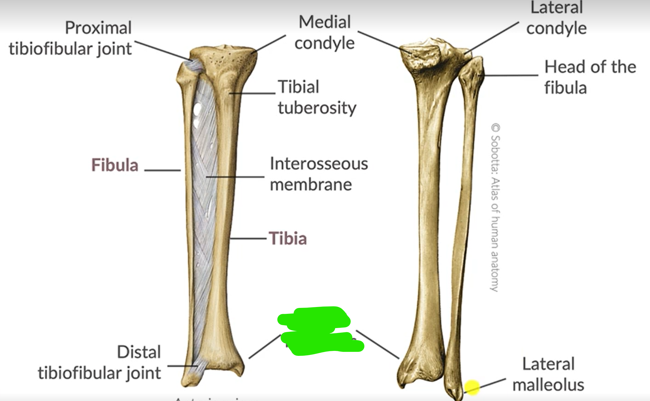 term image