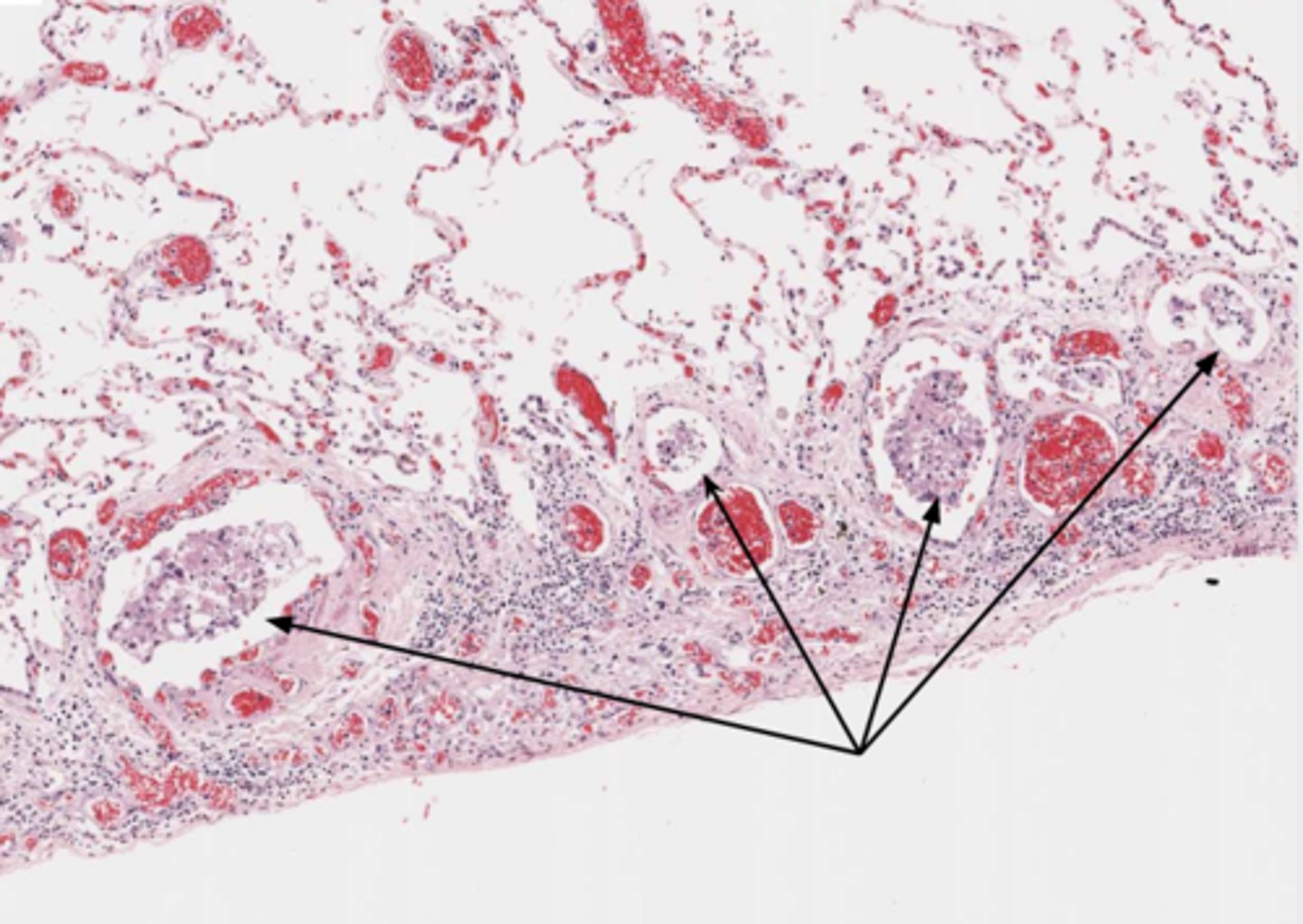 <p>A characteristic feature of cancer cells is metastasis.</p>