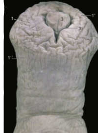 <p>note small differentiation that urethral process makes</p>