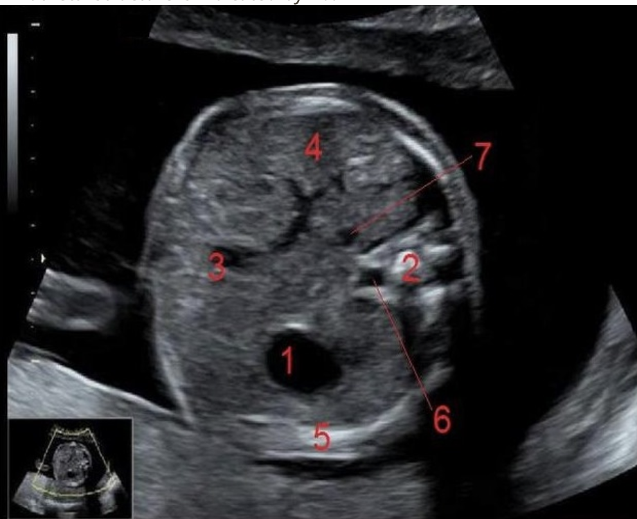 <p>what is #6</p><p>a) IVC</p><p>b) AO</p><p>c) spinal cord</p><p>d) spine</p>