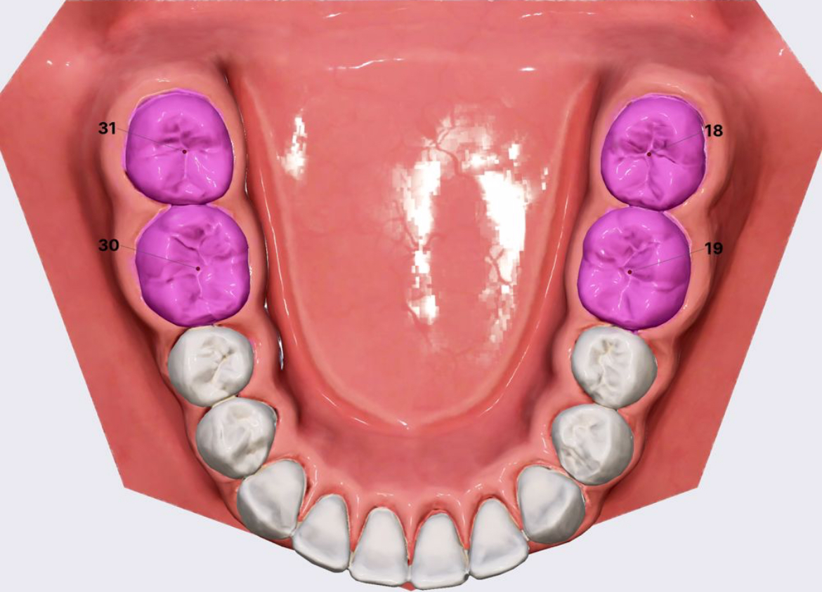 <p>Largest teeth in the mouth with 4-5 cusps/points.</p>