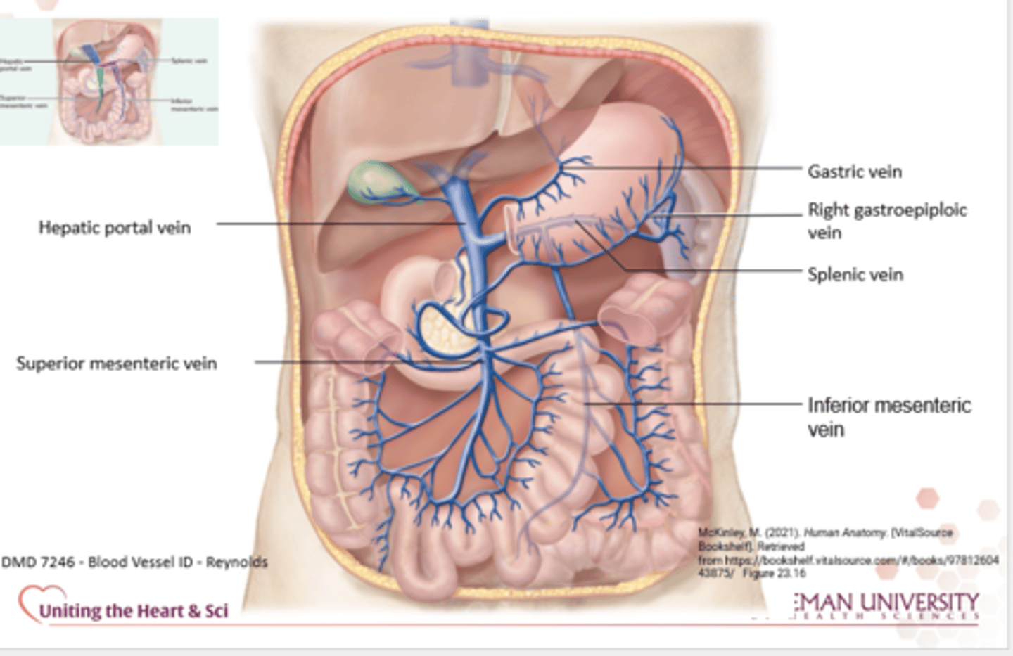 <p>-Carry blood from the liver to the vena cava</p>