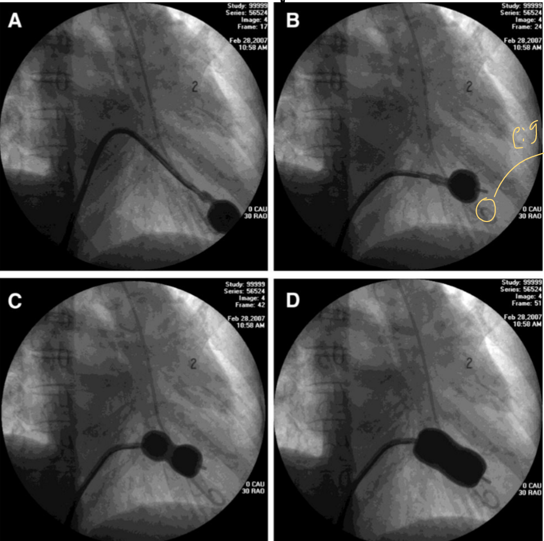 <p>what is occurring in this image </p>