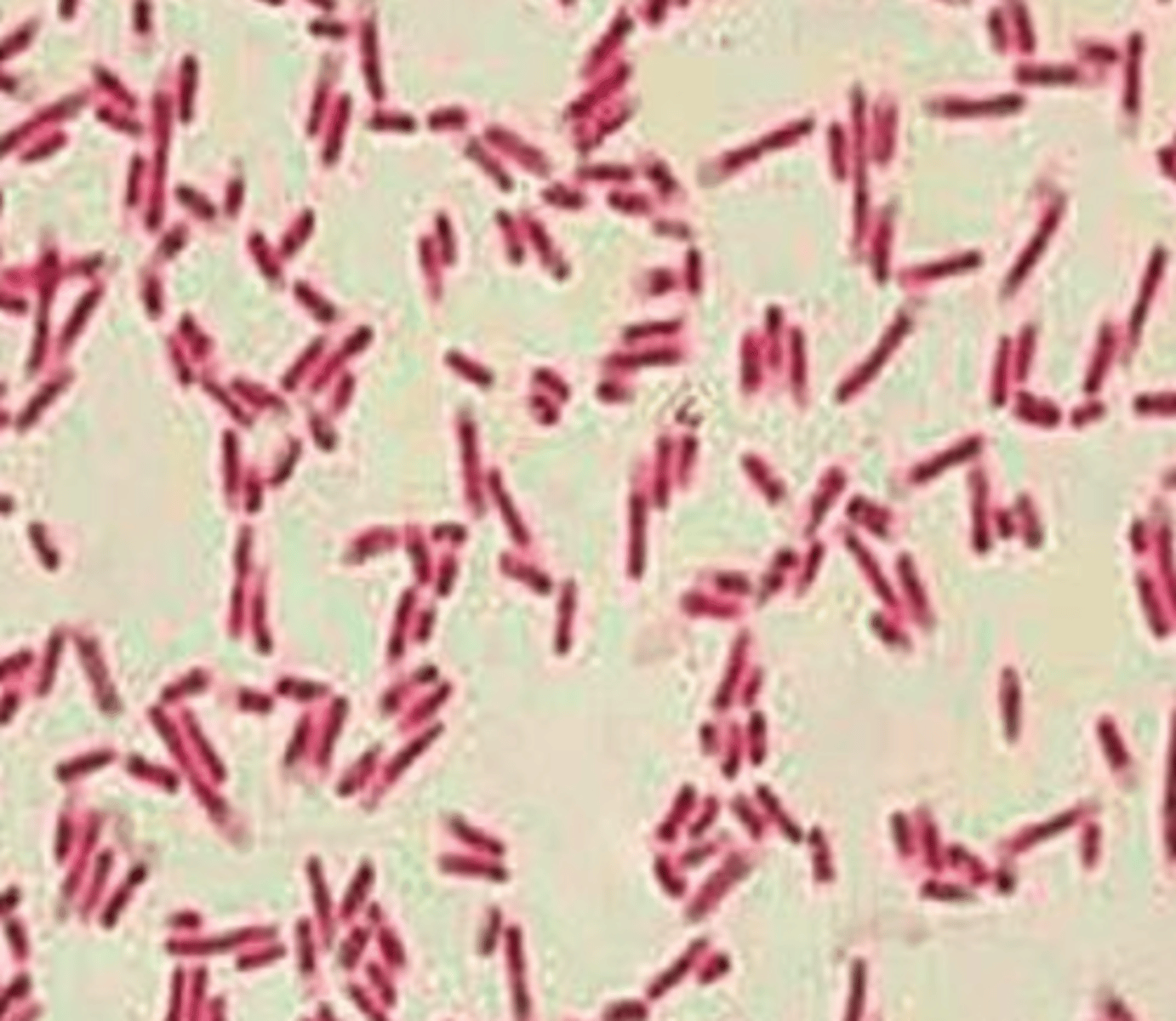 <p>coccus or rods?</p><p>G+ or G-?</p>