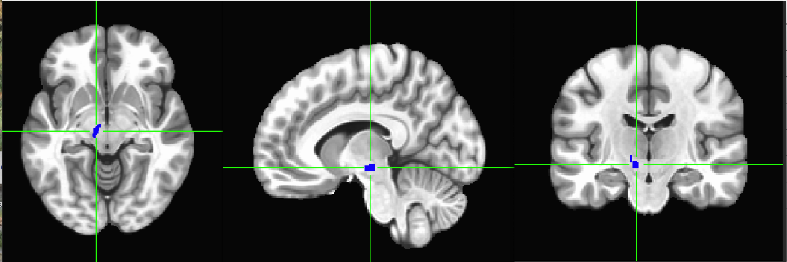 <p>produces dopamine in the left hemisphere and right hemisphere.</p>