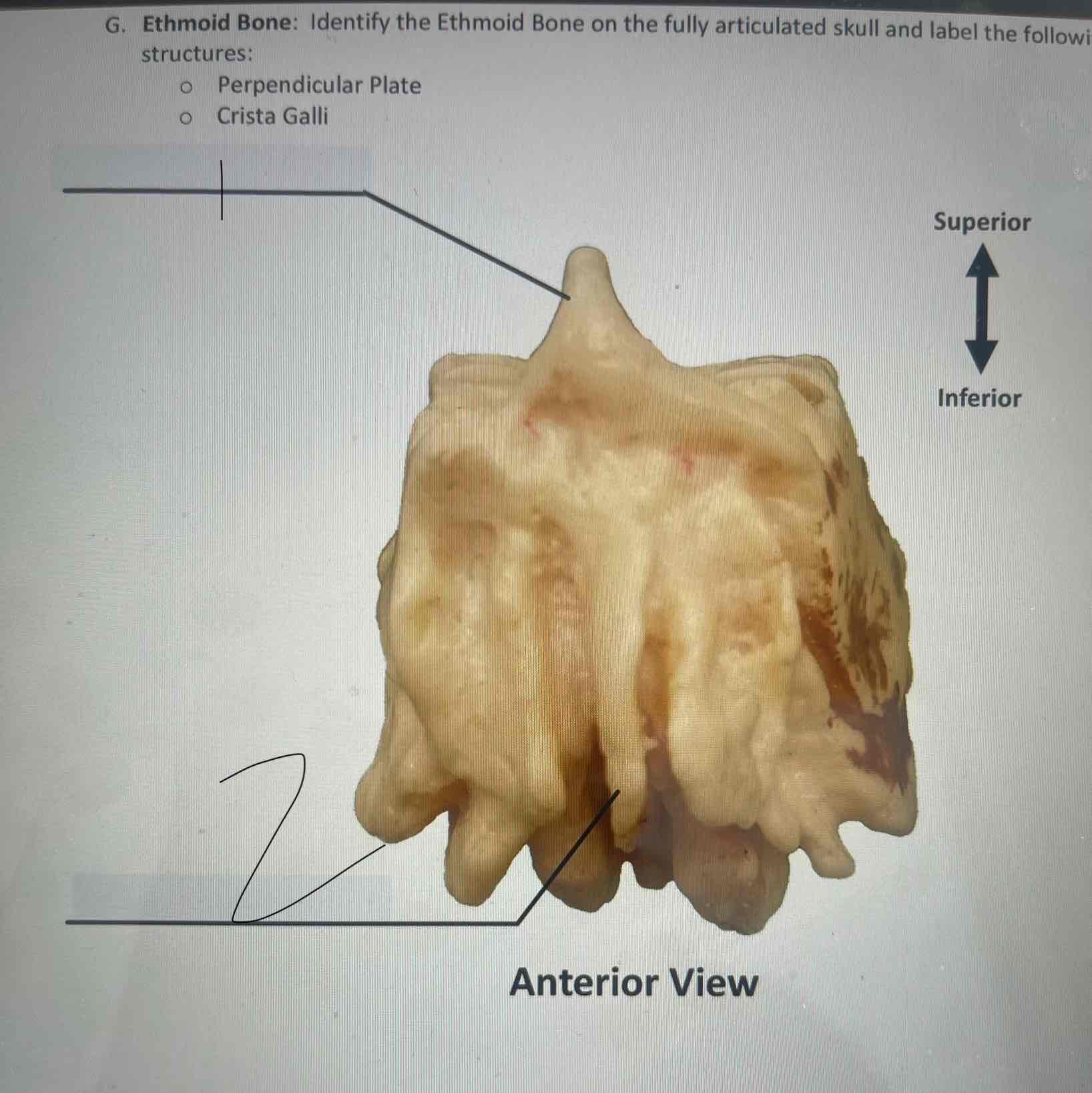 <p>What kind of bone is this?</p>