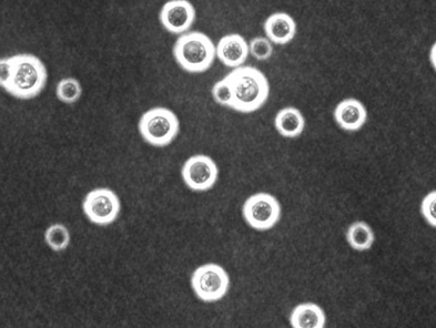 <p>-histopathology is gold standard</p><p>-India ink CSF stains approximately 50% sensitive for CNS disease</p><p>-CSF studies will often reveal a mononuclear or lymphocytic pleocytosis, elevated protein, increased opening pressure, and normal glucose</p><p>-cultures are nearly 100% sensitive for CSF and 70-80% sensitive for blood but take several days to return</p><p>-cryptococcal antigen tests for blood and CSF are both sensitive (&gt;90%) and specific (&gt;90%); beta-D-glucan is negative</p><p>-cryptococcal nucleic acid amplification also commonly used</p><p>-MR imaging may reveal leptomeningeal enhancement or cryptococcomas</p>
