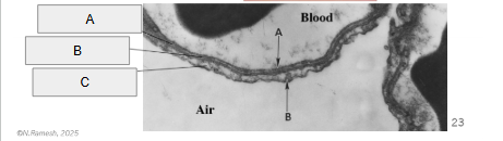 <p>B</p>