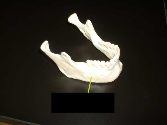 <p>The lower jaw.</p>