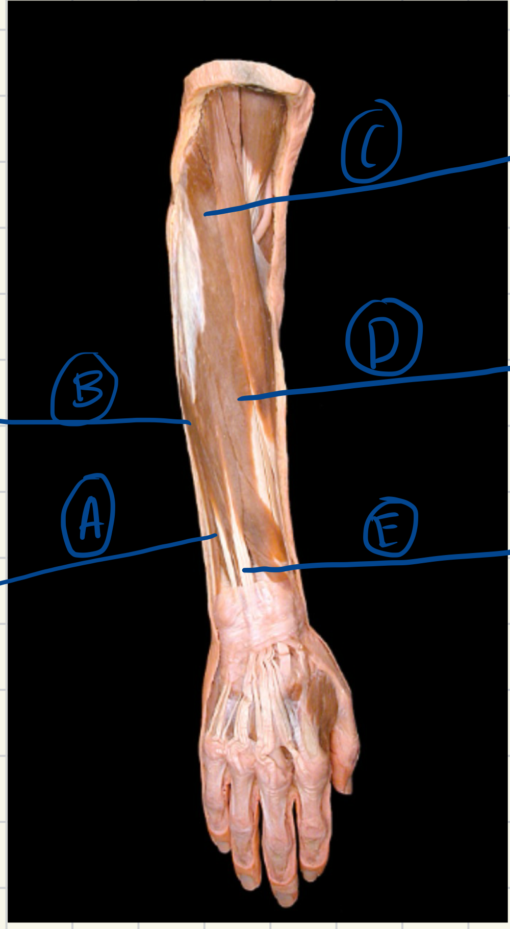 <p>What is muscle A ? (Origin, insertion, action, innervation)</p>