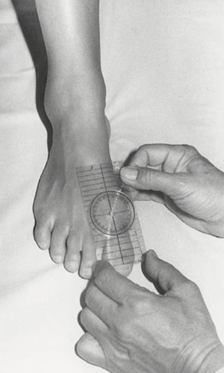 <p>Compare bilaterally</p>