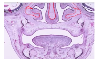 <p>-ethmoid (trabeculae cranium + nasal capsule) and inferior concha form ENTIRELY by endochondral ossification</p><p>-nasal capsule → endo ossif → ectemoid (lateral component of ethmoid bone)</p><p>-lateral labyrinths, superior/middle conchae, inferior concha (inferior concha still attached and this is lost during end ossification)</p>