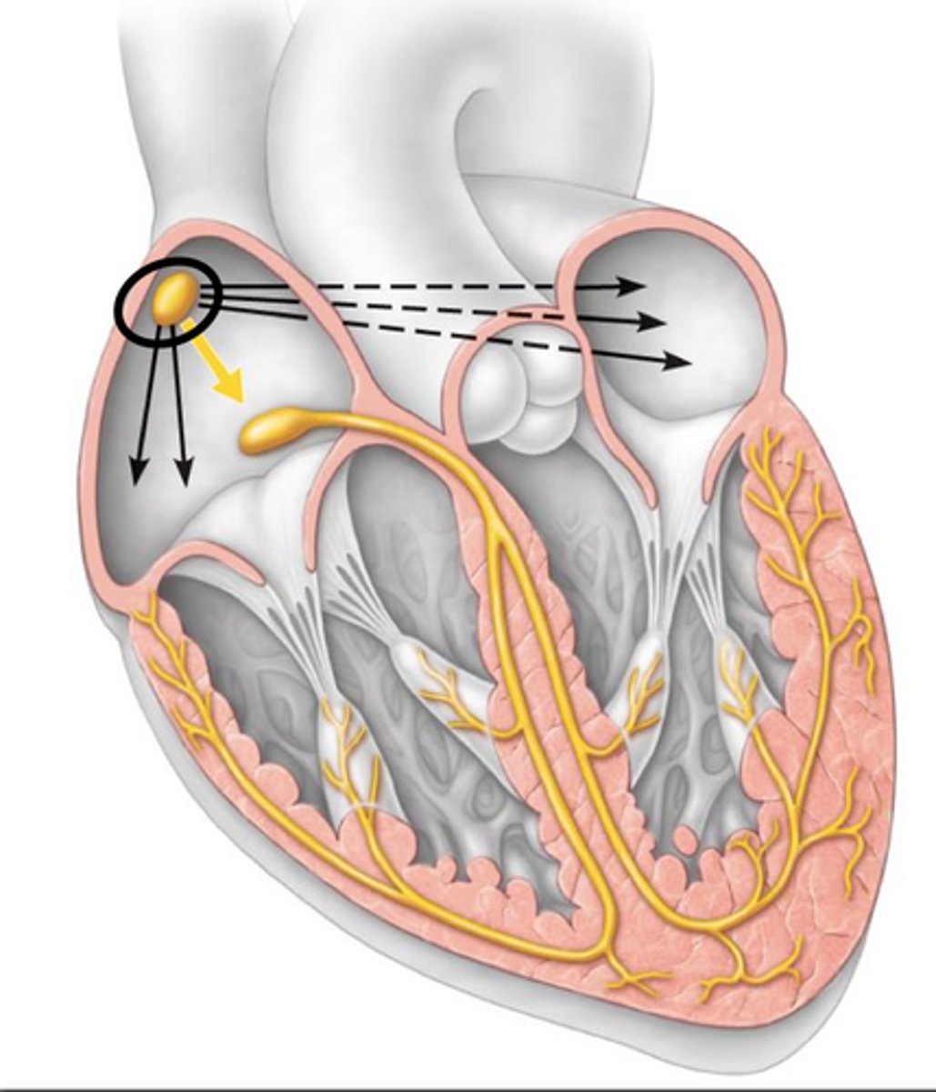 <p>pacemaker of the heart</p><p>- small collection of specialized cells in the right atrium</p><p>- densely innervated with adrenergic and cholinergic nerve terminals</p><p>- neurotransmitters control discharge rate</p><p>> sympathetic nerve terminals: positive chronotropic response; beta-1 receptor activated pathway</p><p>> parasympathetic nerve terminals: negative chronotropic response; acetylcholine activating muscarinic receptors</p><p>- signals the atria to contract and pump blood into left and right ventricles, then signal spread to conduction tissue in the AV junction, spreads to left and right bundle branches, and transmits stimulus to ventricular muscle cells</p>