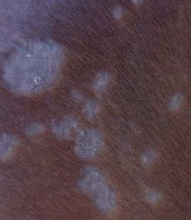 <p>What is the term for the condition also known as ringworm which is zoonotic, invades the hair shaft, is caused by Trichophyton or Microsporum fungi, is often in the tack area, does not cause pruritus, is diagnosed through microscope and culture, is treated with eniconazole, can be self-limiting, and can also be vaccinated against?</p>