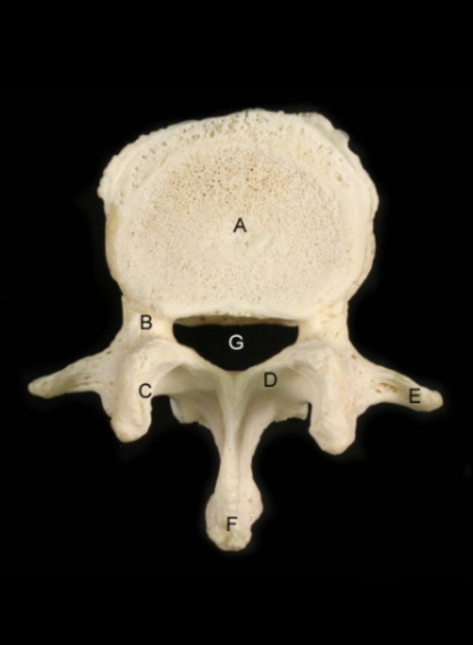 <p>Identify the Structures of the Lumbar Vertebrae - L3 Superior View</p>