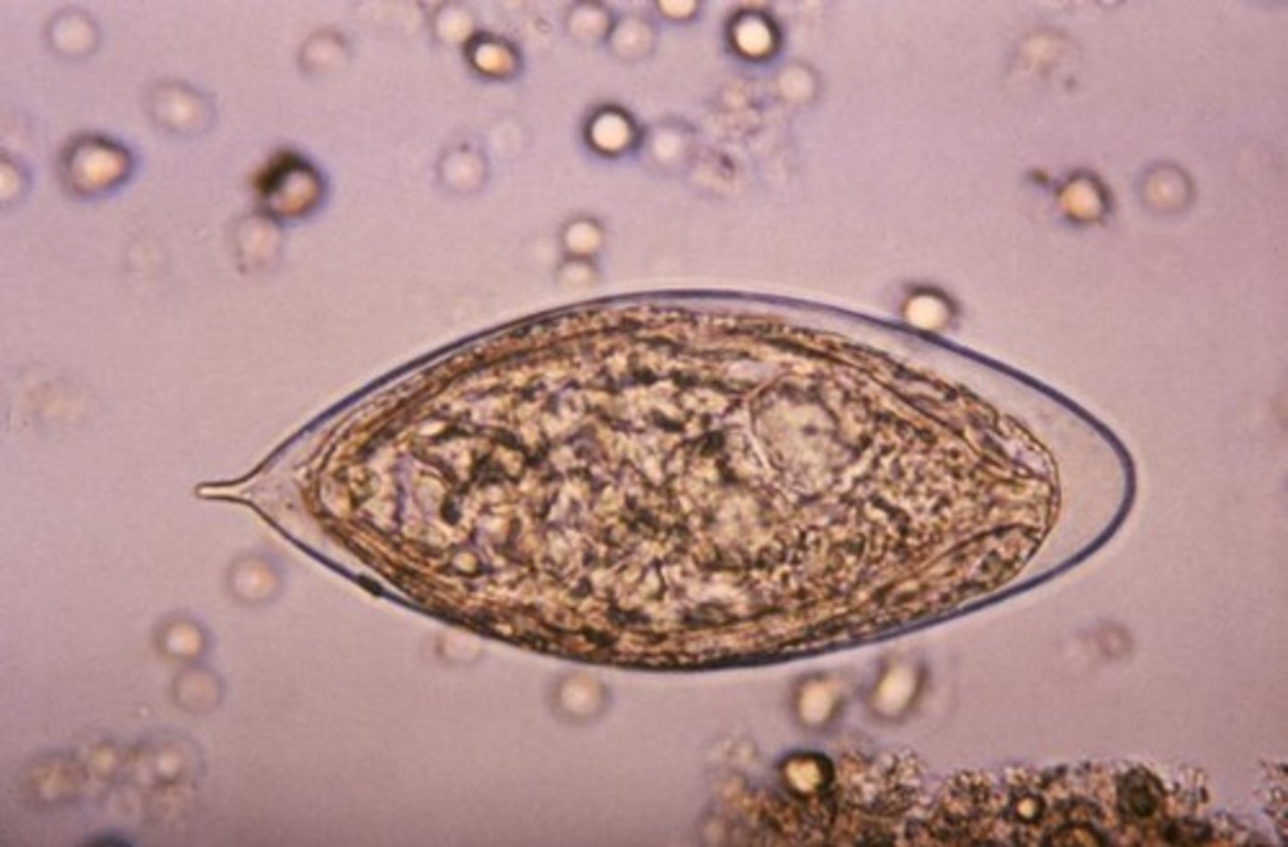 <p>Terminal Spine</p>