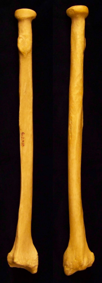 <p>Which bone is shown?</p>