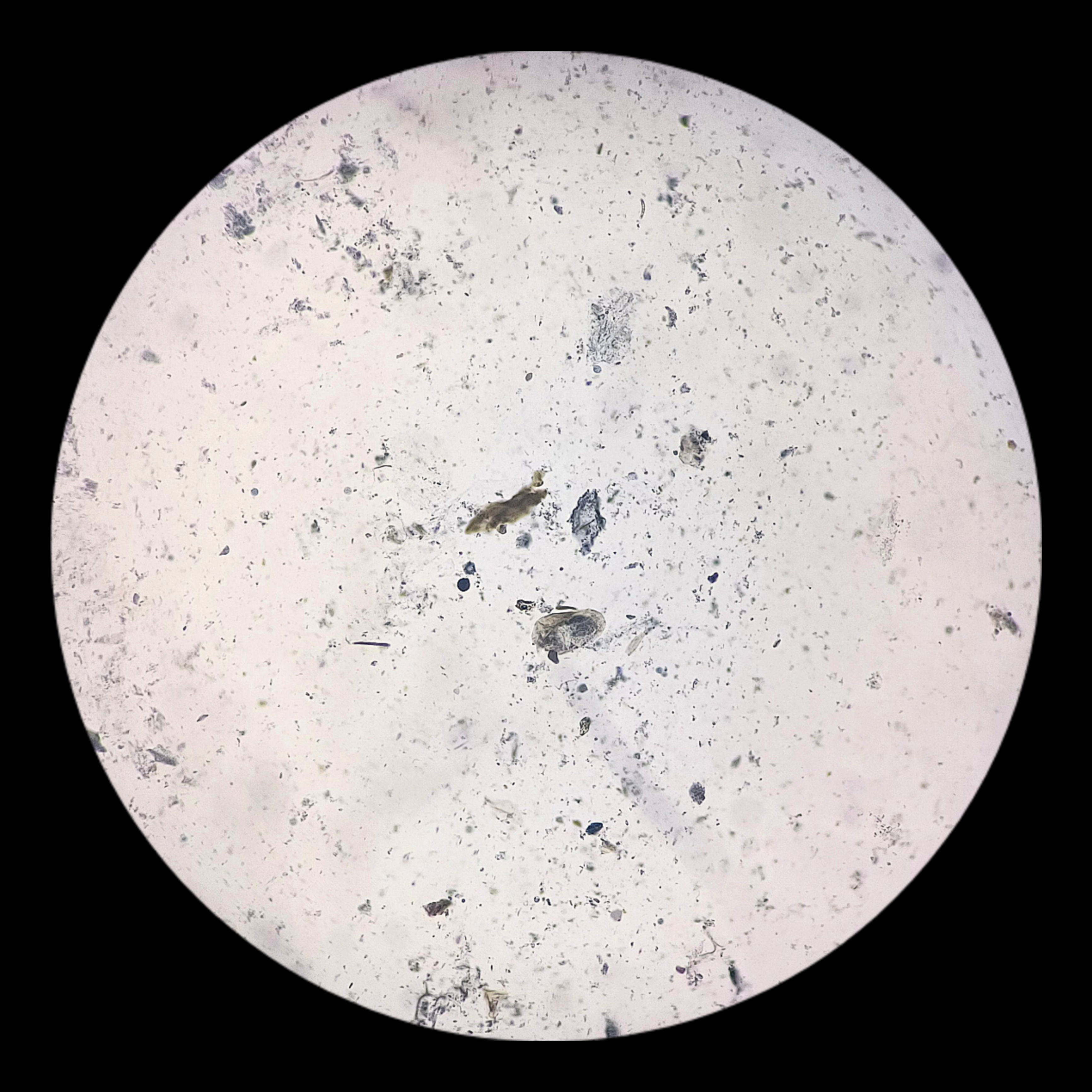 <p>Class of <em>Entamoeba histolytica</em></p>