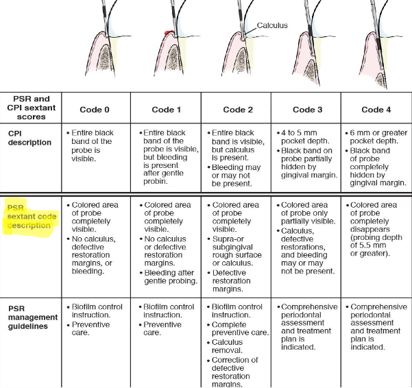 <p><strong>Step 1</strong></p><ul><li><p>Probe all surfaces of teeth in each sextant (with WHO probe in alcove)</p></li></ul><p><strong>Step 2</strong></p><ul><li><p>Each sextant receives one code number corresponding to the deepest position of the color coded portion of the probe (highest code documented) </p></li></ul><p></p>