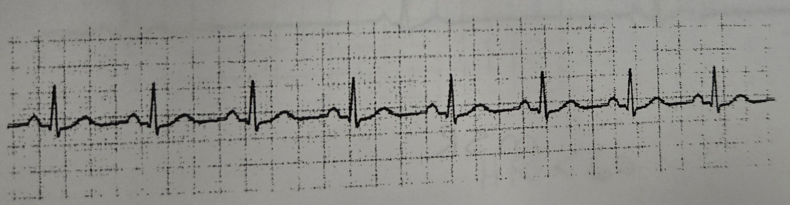 <p>What Rhythm is this?</p>