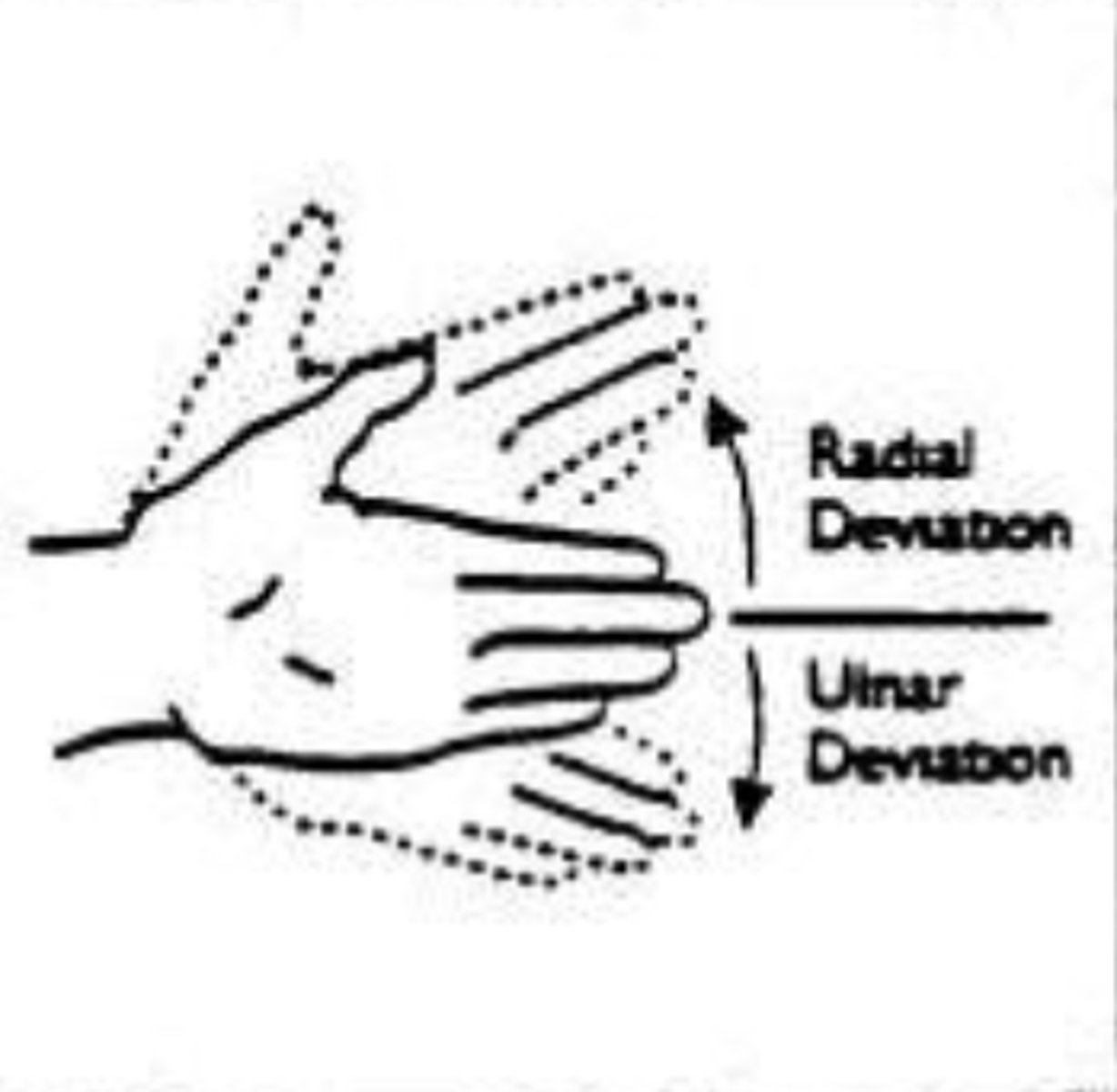 <p>Movement of the wrist towards the ulna or medial side, towards pinky side</p>