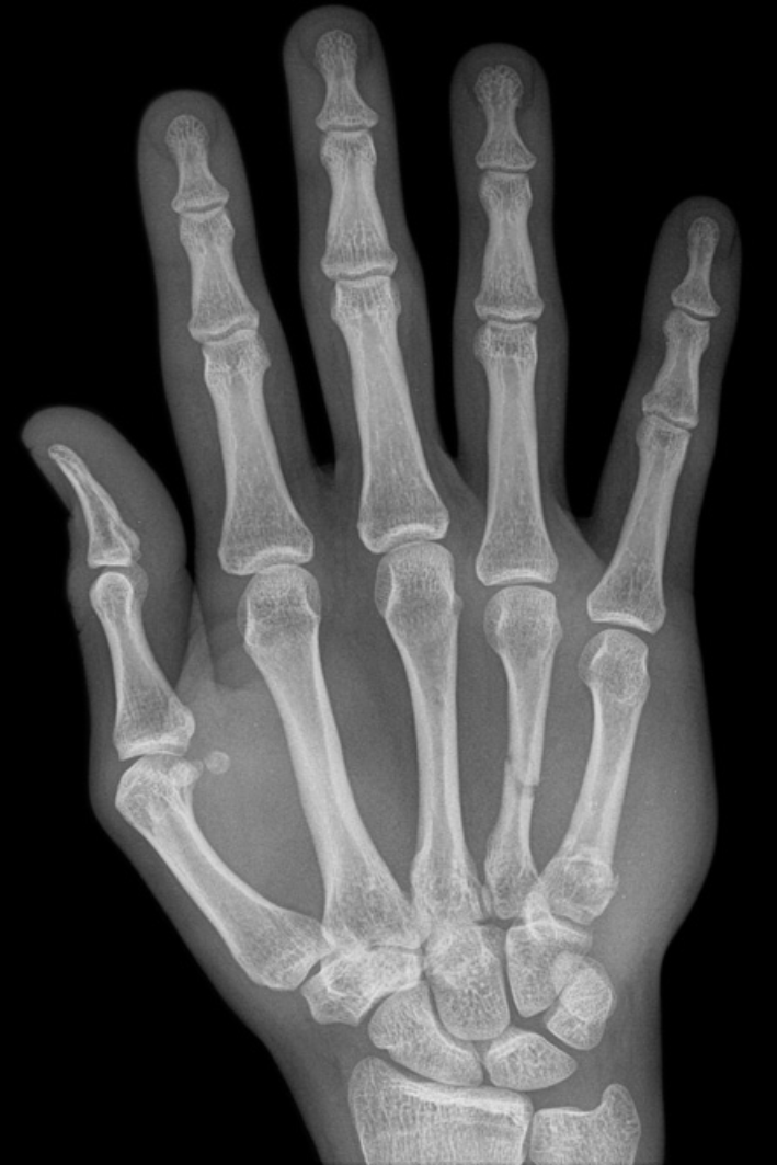 <p>Describe the abnormality demonstrated.</p>