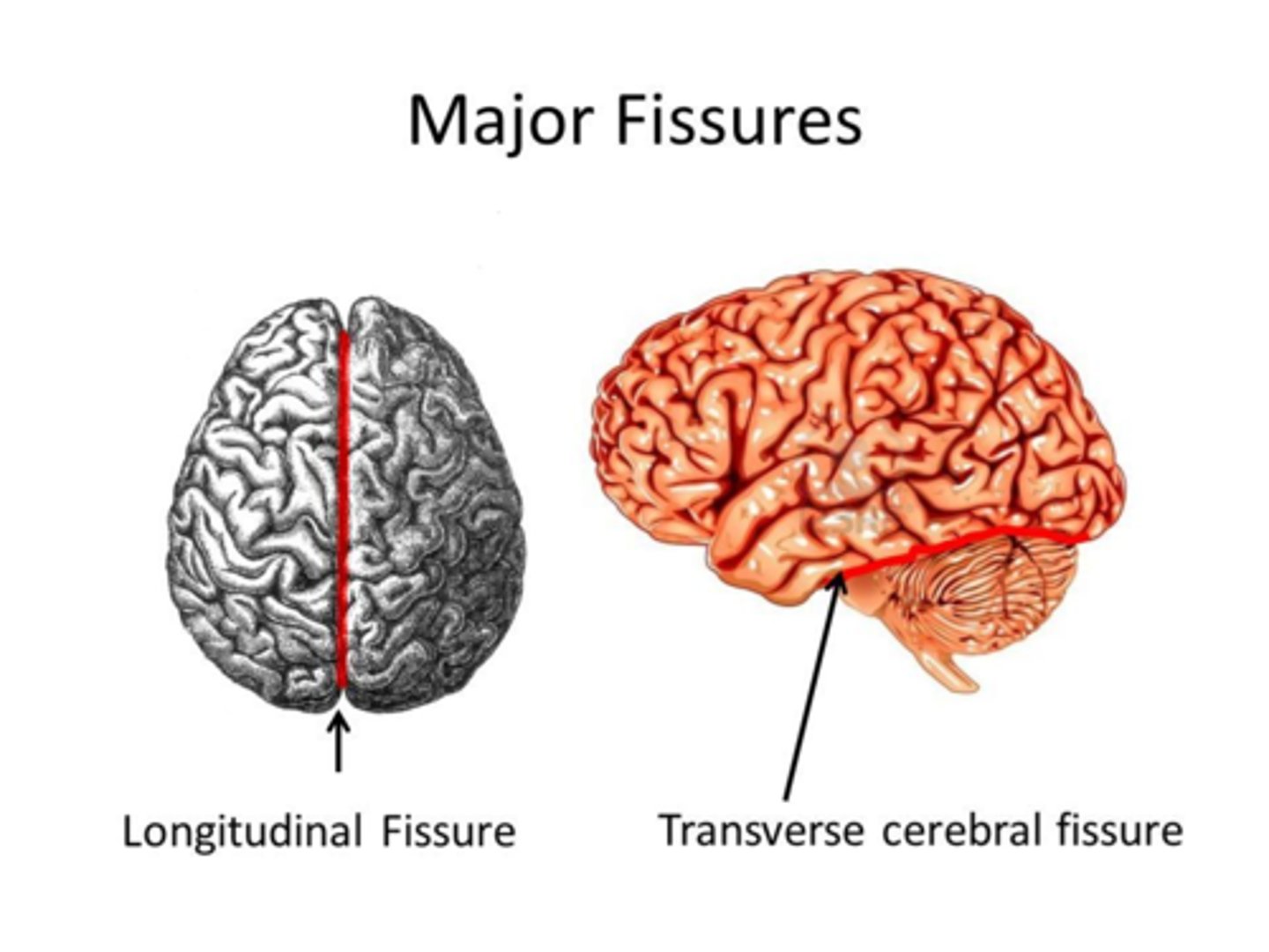 <p>szczelina podłużna mózgu</p>