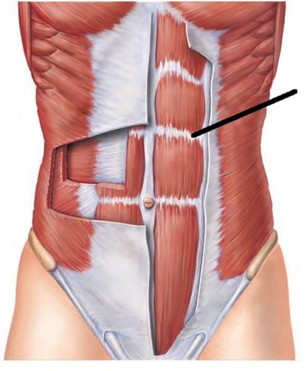 <p>Small connective tissue bands which run horizontally across rectus abdominis</p>