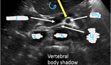 <p>In this transverse view, what is #6?</p>