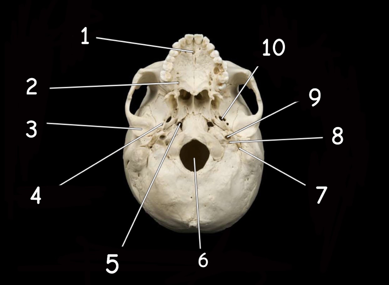 term image
