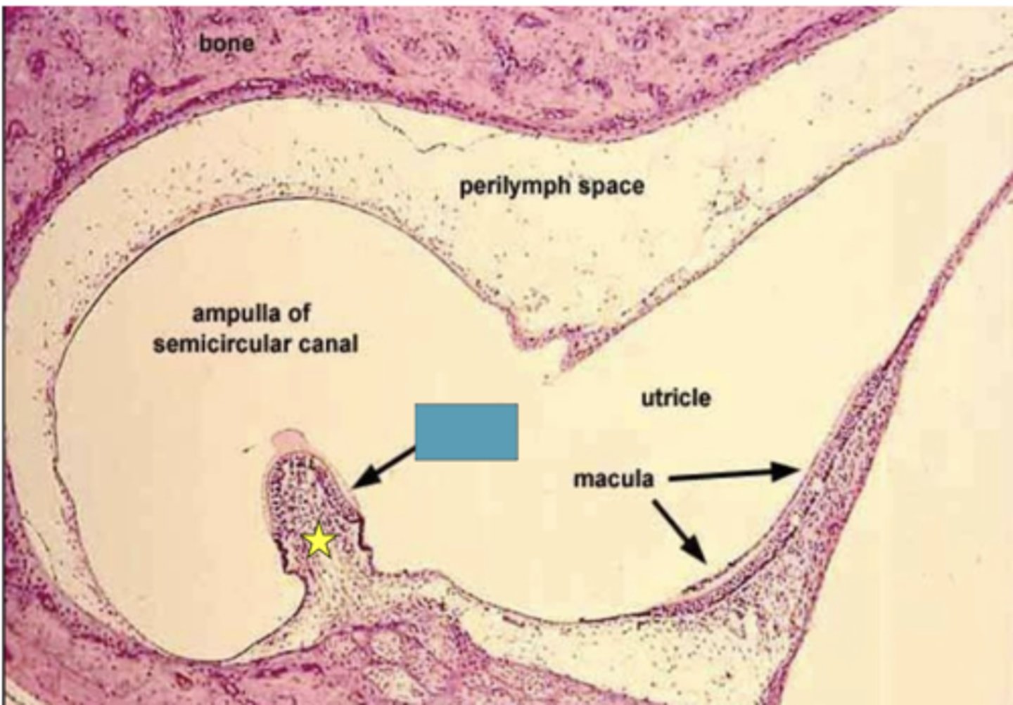 <p>Identify the following structure</p>