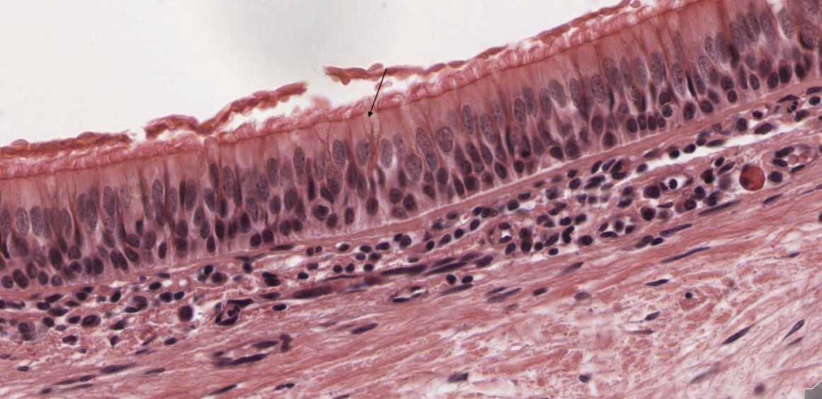 <p>Epitelio pseudoestratificado cilíndrico con cilios y células caliciformes epitelio respiratorio tráquea</p>